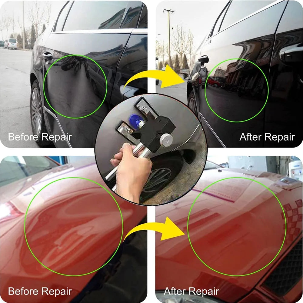 DentFix Auto-Dellen-Reparaturset für Karosserie - Beulen- und Dellenentferner